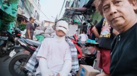 Tragedi Kebakaran Tambora: Pengorbanan Seorang Ayah yang Membekas Luka di Tubuh dan Jiwa