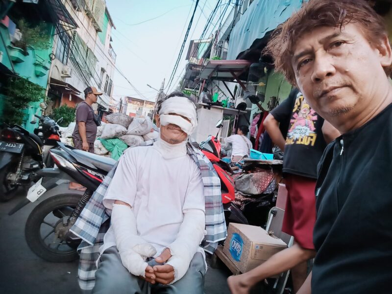 Tragedi Kebakaran Tambora: Pengorbanan Seorang Ayah yang Membekas Luka di Tubuh dan Jiwa