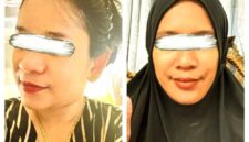 Foto: Kolase Terduga Pelaku Penipuan. (kiri) Meity Jayasari alias Suri. (kanan) Suryani alias Ani. (Dok-Istimewa)